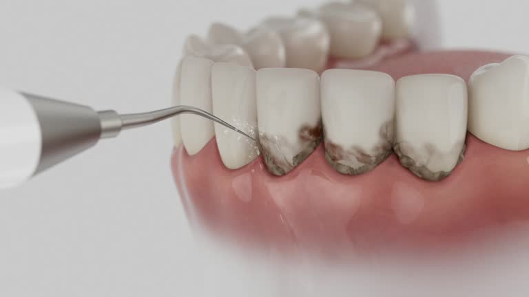 Reliable Wisdom Tooth Removal contractor in Early County County, GA by Dentist Open Now